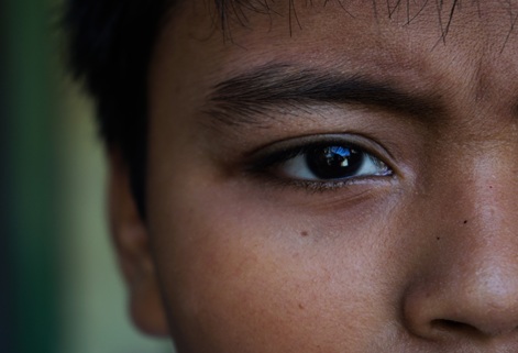 AkshayNetra - Eye Image